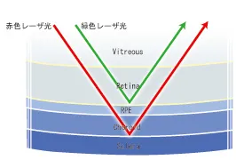 赤・緑レーザーの眼底反射深さの模式図
